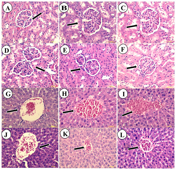 Hematoxylin and eosin stained histopathological sections of livers and kidneys of male and female SD-rats.