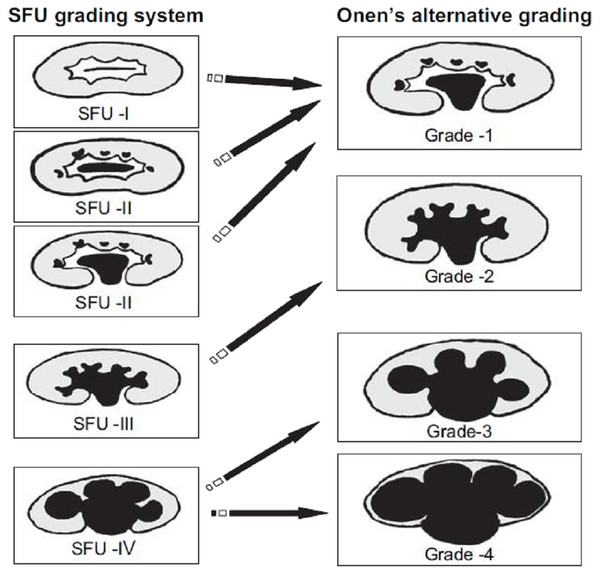 Comparison of SFU and Onen’s hydronephrosis grading system AGS.