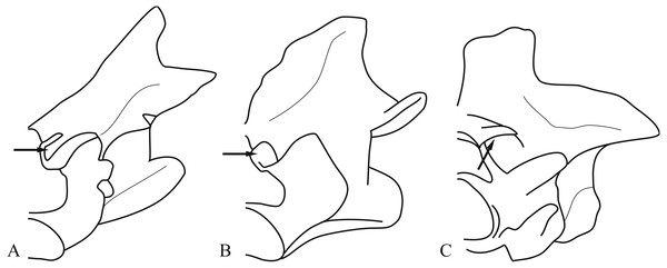 Geometries of zygosphene-zygantrum intervertebral articulations (description in text).