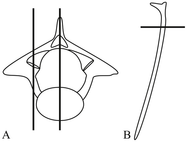 Thin-sectioning planes through the vertebrae (A) and ribs (B).