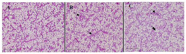 Liver histopathology of juvenile barramundi fed on TH diets without or with fermentation for 56 days.