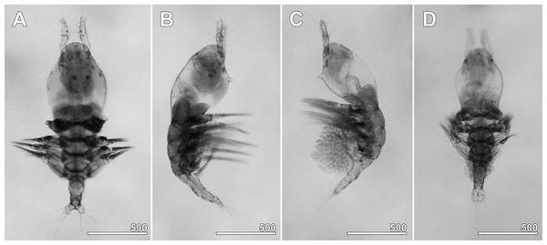 Monstrillopsis longilobata Lee, Kim & Chang, 2016, microphotographs of females.