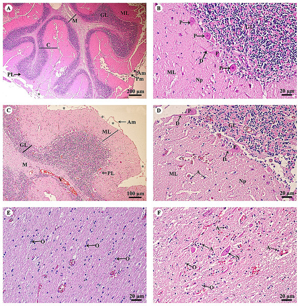 Light microscopy micrographs at different magnifications of the cerebellar hemisphere (A, B) and cerebellar vermis (C–F).