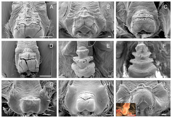 Scanning electron micrographs and light micrograph of the medial tooth of Dilocarcininae (A–F) and Trichodactylinae (G–I) species.