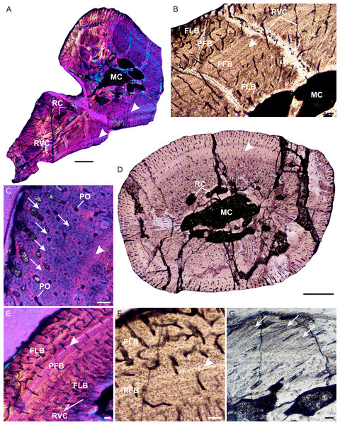 Limb bone osteohistology of Prozostrodon brasiliensis UFRGS-PV-248-T.