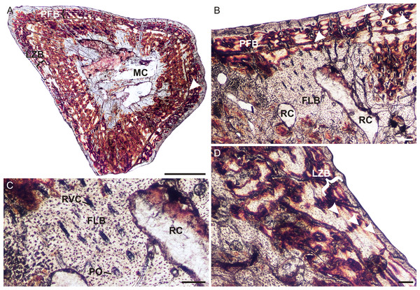 Humeral osteohistology of Irajatherium hernandezi UFRGS-PV-1072-T.