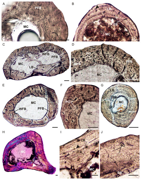Limb bone osteohistology of Brasilitherium riograndensis.