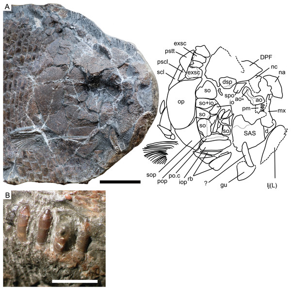 Cranial morphology of Dapedium ballei sp. nov. (SMNS 96990).