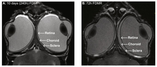 MRI images of chick eye following 10 days of FDM induction and 3 days recovery.