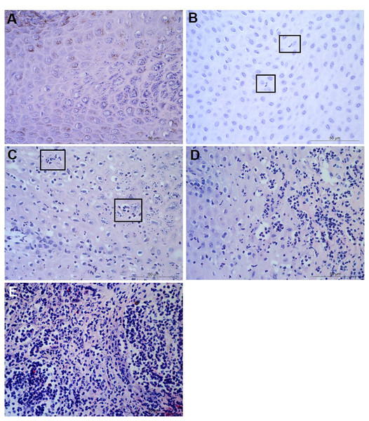 Descriptors of leukocyte cell infiltration in ovine interdigital skin epidermis.