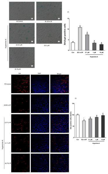 The expression of SA-β-gal and Edu by immunofluorescence labeling.