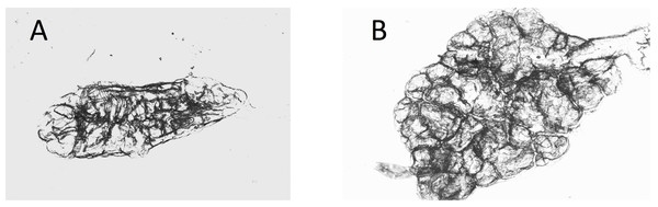 Dry ovaries of Anopheles arabiensis (A) nulliparous; (B) parous.