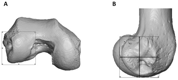 Partitioning of the lateral condyle into sub-regions in a Pan specimen.