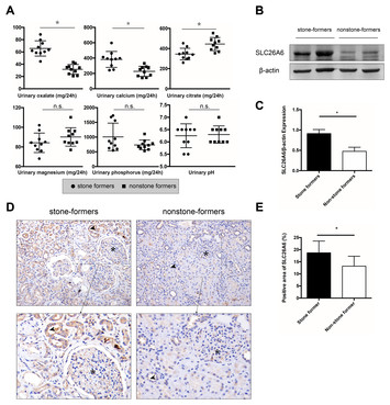 High expression of SLC26A6 in the kidney may contribute to renal ...