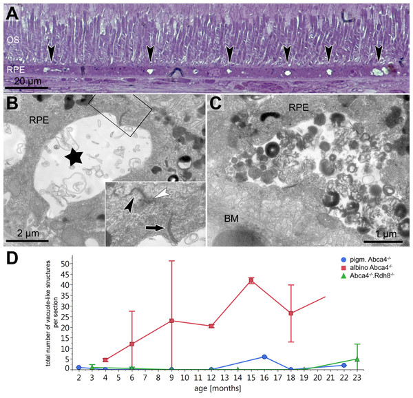 Vacuole-like structures in RPE cells are most prominent in albino Abca4−∕− mice.
