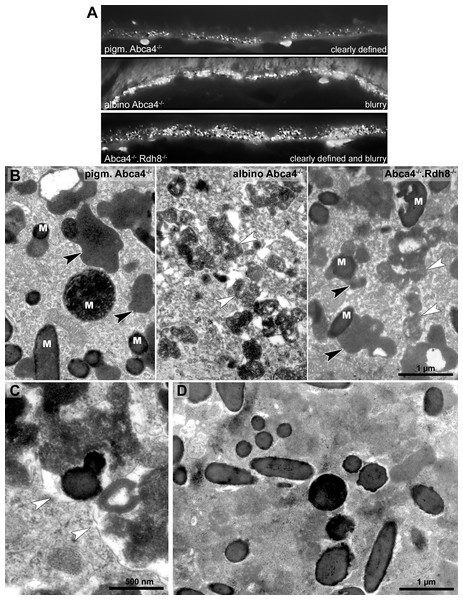 Lipofuscin in Stargardt mice is highly variable in fluorescence and electron microscopy.