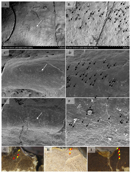 SEM (SE) and histological observations of clavicle radial ridges for Tc2.