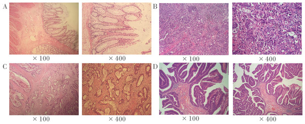 Representative histopathological photographs.