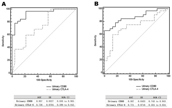 Receiver operating characteristic curves (ROC) for urinary CD80 with CTLA-4 levels differentiating patients with steroids-sensitive MCD and others.