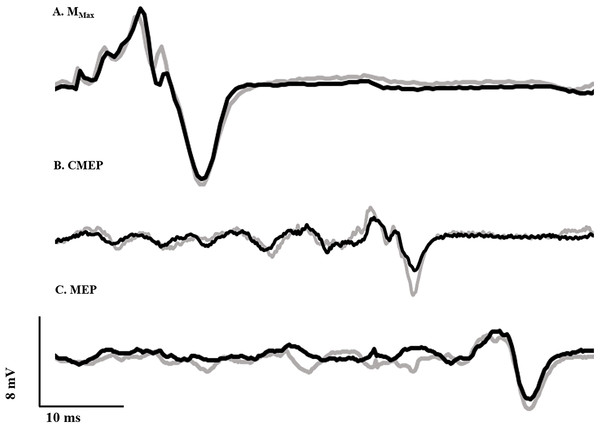 Evoked potential raw traces.