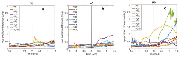 Binocular divergence in dichoptic condition.