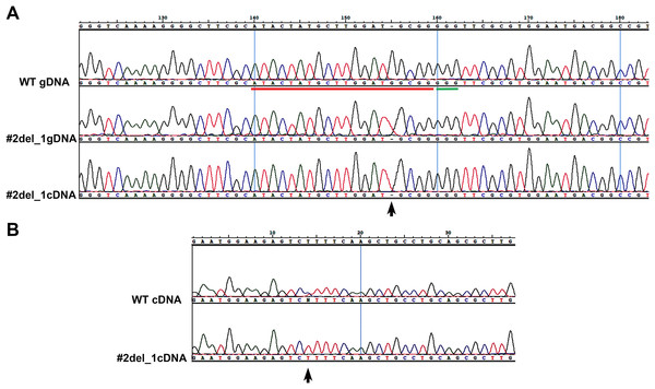 Single nucleotide deletion generated in transformant clone #2 and SNPs analysis of the target cDNA.