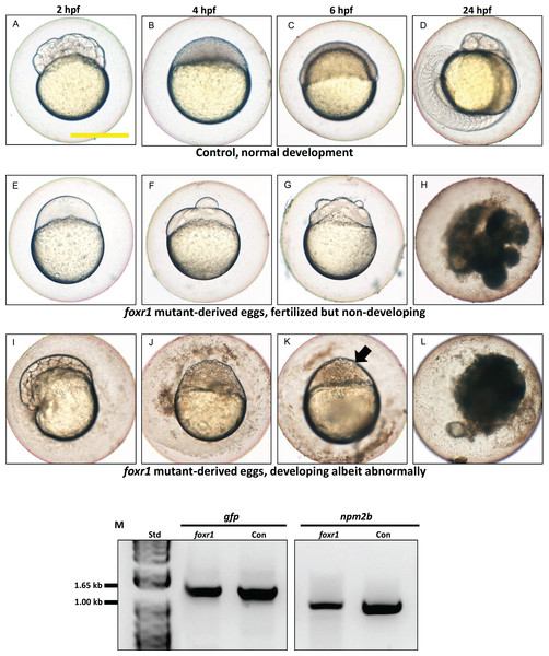 Effect of foxr1 deficiency on zebrafish embryogenesis.
