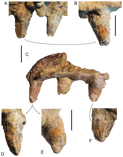 Maxillary teeth of Kwanzacetus khoisani.