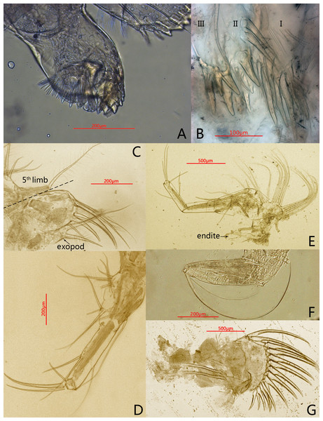 Photomicrographs of Conchoecissa nigromaculatus sp. nov., ♀.