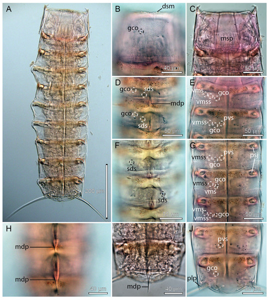 Light micrographs showing overviews and details of female holotype, NHMD-233053, of Cristaphyes glaurung sp. nov.