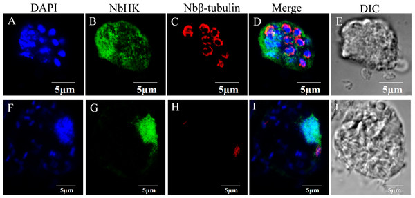 Subcellular localization of NbHK in infected Sf9-III.