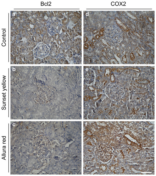 Immunohistochemical microscopic images showing the expression of Bcl2 and COX2 in the kidney of rat.