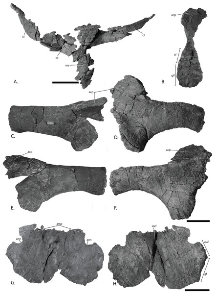Pectoral girdle of PMO 222.669, referred specimen of P. hoybergeti.