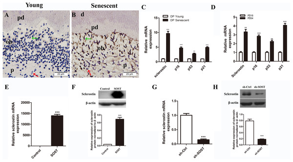 Expressions of sclerostin in senescent dental pulp, subculture-induced senescent HDPCs and lentiviral infected HDPCs.