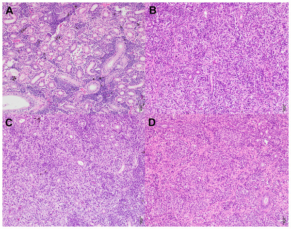 Histologicalimages of the posterior kidney.