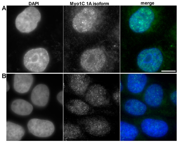  Immunofluorescent anti myosin 1C isoform A staining of PC3 (A) and RWPE-1 (B) cells.