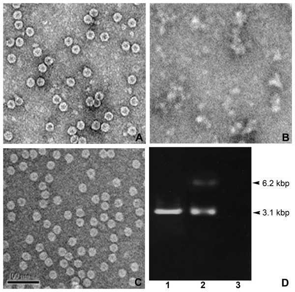 TEM structures of VLPs and encapsidation.