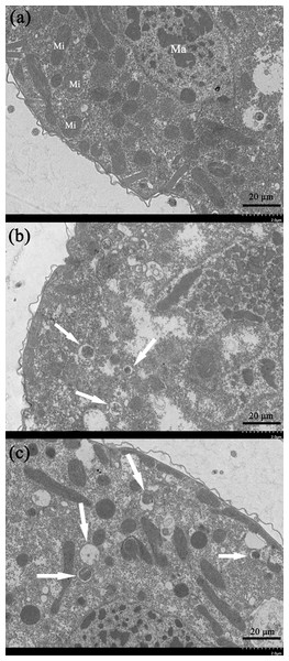 Ultrastructural analysis by TEM of T. thermophila cells exposed to increasing concentrations of gelsemine for 24 h.