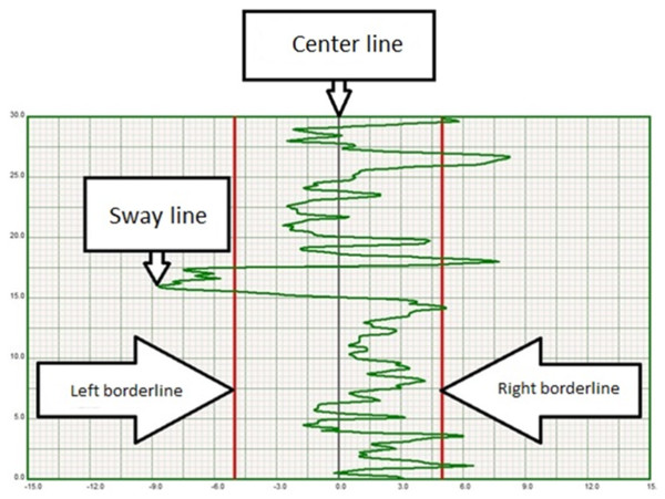Exemplary stabilogram illustrating sway line amplitude in relation to center and border lines.