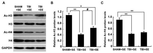 EE improves Ac-H3 protein expression in the prefrontal cortex of contralateral side of TBI.