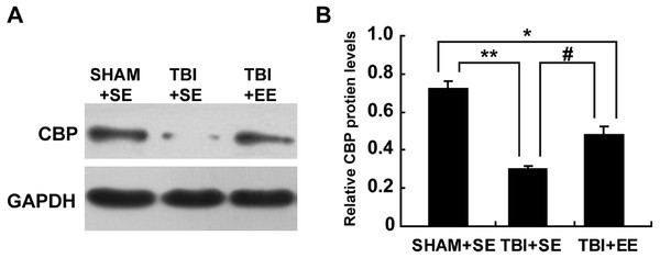 EE enhances CBP protein expression in the prefrontal cortex of contralateral side of TBI.
