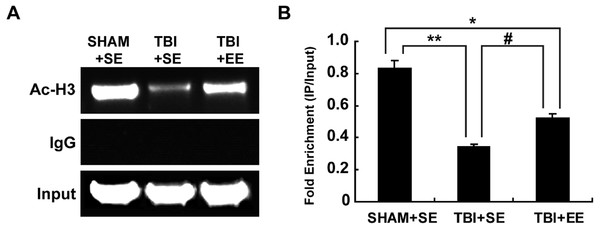 EE increases histone H3 acetylation at ChAT gene M-type promoter region in the prefrontal cortex of contralateral side of TBI.