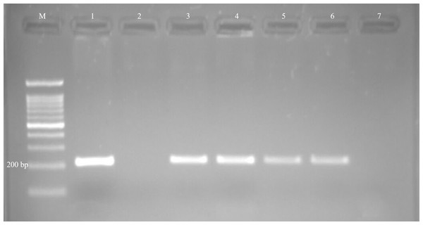 Examples of agarose gel electrophoresis of Neospora caninum obtained by nested-PCR.