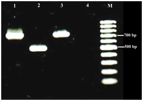 Examples of agarose gel electrophoresis of Brucella species PCR products using multiplex PCR.