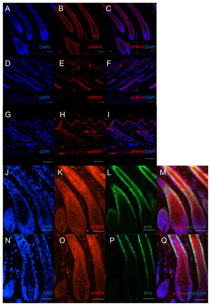 The expression of sFRP4 in mouse dorsal skin.