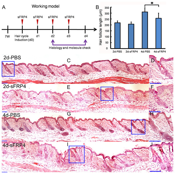 sFRP4 inhibited the growth of hair follicle.