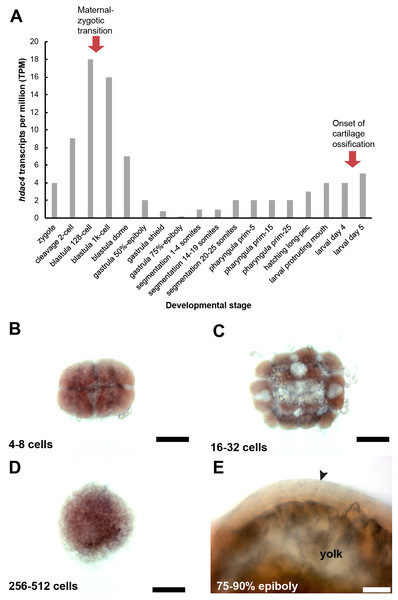 Expression of hdac4 mRNA transcripts at different stages of embryonic and larval development.