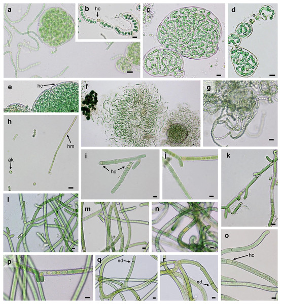 Microphotographs of heterocystous cyanobacteria.