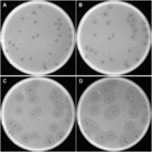 Identification and characterization of capsule depolymerase Dpo48 from ...