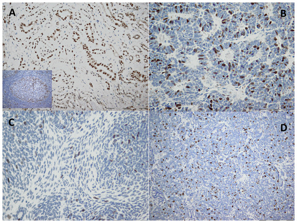 Immunohistochemical staining of cyclin A in kidney tissue.